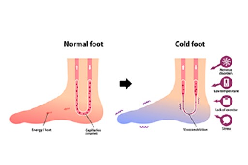 Causes Symptoms and Treatment for Poor Circulation in the Feet