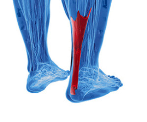 Large discount achilles tendon